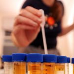 All about DNA Testing in Rape Cases DNA testing