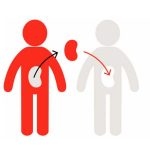 Evaluating the laws governing organ transplantation with respect to the US Organ transplantation